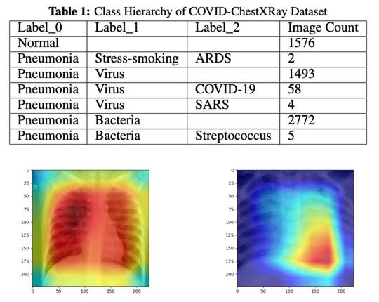 Vision Transformer for Chest X-Ray Classification